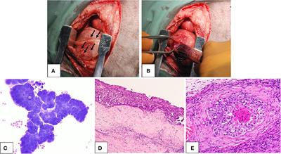 Chemosensitivity of three patient-derived primary cultures of canine pericardial mesothelioma by single-agent and combination treatment